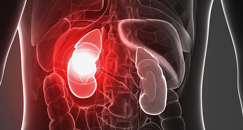 Symptoms of kidney disease
